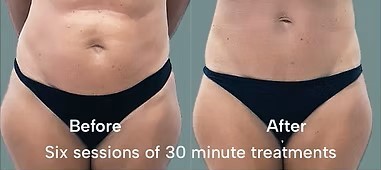 Before & after 1