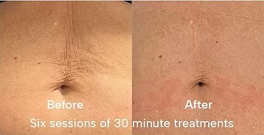 Before & after 2