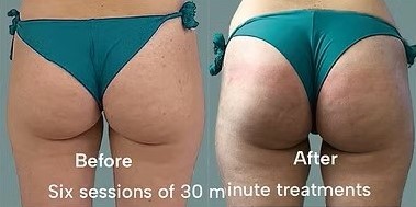Before & after 3