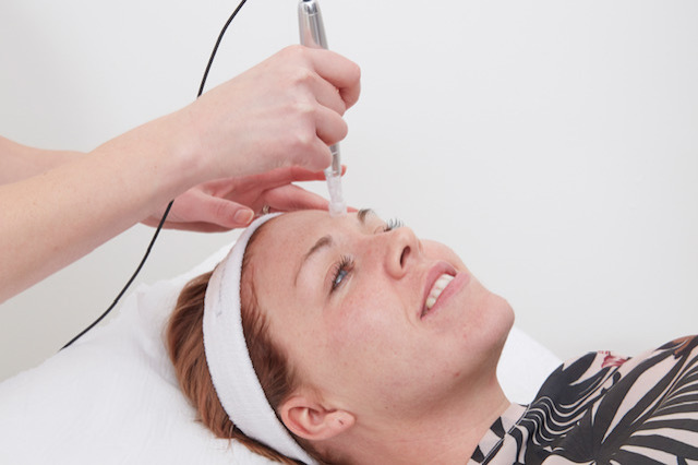 eDermastamp microneedling treatment