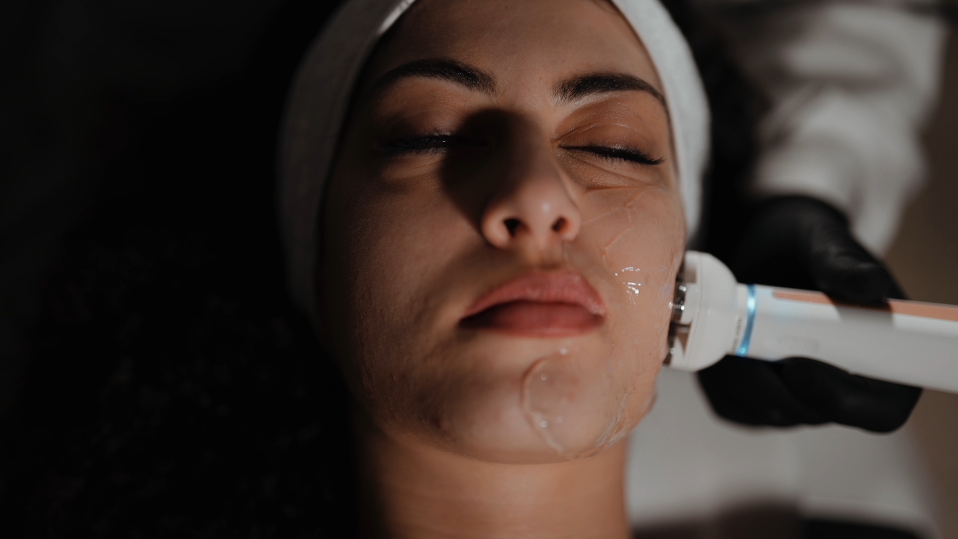 FaceStim Facial results — firmer, more lifted appearance